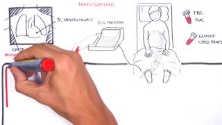 Acute Coronary Syndrome DETAILED Overview MI STEMI NSTEMI [upl. by Benny443]