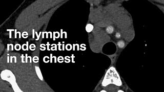 The Lymph Node Stations in the Chest [upl. by Ellennoj]