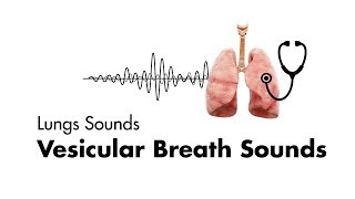 Vesicular Breath Sounds  Normal Lung Sounds  MEDZCOOL [upl. by Orpha]