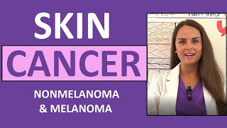 Skin Cancer Basal Squamous Cell Carcinoma Melanoma Actinic Keratosis Nursing NCLEX [upl. by Oremar154]