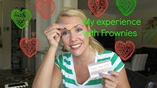 My experience with Frownies with before and after photo  BEAUTY OVER 40 [upl. by Suilmann520]