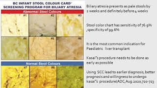 stool colour chart [upl. by Singleton]