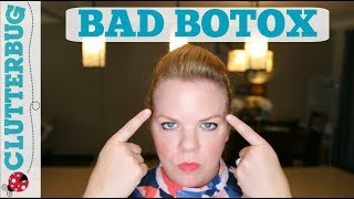 My Bad Botox Experience [upl. by Nangem127]