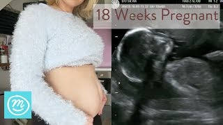 18 Weeks Pregnant What You Need To Know  Channel Mum [upl. by Viquelia]