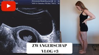 EERSTE ECHO amp MISSELIJK  6 7 amp 8 weken  ZWANGERSCHAP VLOG 3 [upl. by Wiatt]