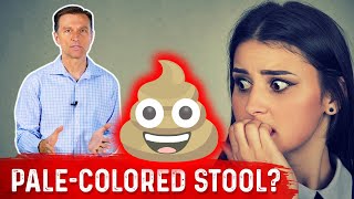 What Does PaleColored Poop Mean – DrBerg [upl. by Belcher]