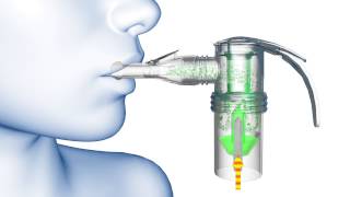 PARI LC® Nebulizer Animation [upl. by Eittocs195]