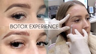 Everything To Know About Botox For Face TMJ Hyperhidrosis  Beauty Transformations [upl. by Carmelia]