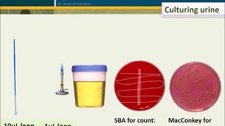 Urine Culture How To Interpret Count [upl. by Templa]