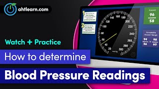 Do you have orthostatic hypotension Light Headed with Standing [upl. by Wolk]