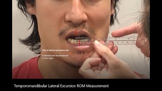 Range of Motion Temporomandibular TMJ Lateral Excursion [upl. by Gittle]