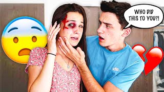 I GOT BEAT UP PRANK ON FIANCE CUTE REACTION [upl. by Fanni]