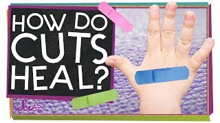 How Do Cuts Heal [upl. by Grae]