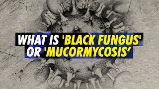 Black Fungus or Mucormycosis Deadly fungal infection making some COVID19 patients blind in India [upl. by Laehctim]