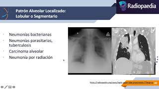 Imagenología de Tórax Patologías [upl. by Ilatfen]