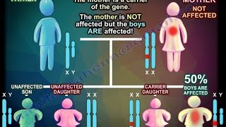 X Linked Recessive Inheritance  Everything You Need To Know  Dr Nabil Ebraheim [upl. by Yesmar]