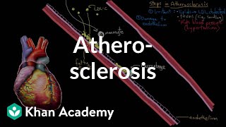 Atherosclerosis  Circulatory System and Disease  NCLEXRN  Khan Academy [upl. by Ecirtahs]