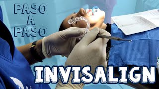 Ortodoncia invisible invisalign│Paso a Paso [upl. by Lennard754]