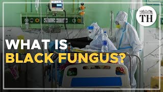 What is black fungus and what causes the infection in COVID19 patients [upl. by Mathis]