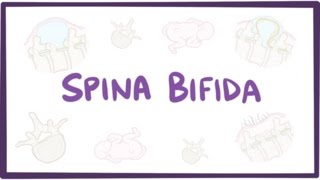 Spina bifida myelomeningocele meningocele occulta  causes symptoms treatment [upl. by Haissem589]