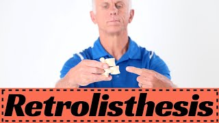 Retrolisthesis Back Pain 5 Best Exercises Treatment to STOP Pain [upl. by Elaen]