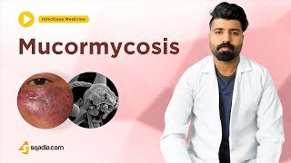 Mucormycosis  Infectious Medicine  Clinical Video Lectures  VLearning  sqadiacom [upl. by Philpot]