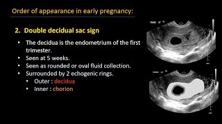 Ultrasound of normal early pregnancy [upl. by Horatio]