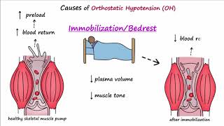 Orthostatic Hypotension Described Concisely [upl. by Almallah]