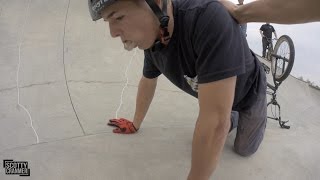 MATTY SLAMS HARD AT THE SKATEPARK [upl. by Nave780]