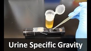 Urine Specific Gravity Refractometer [upl. by Wynnie]