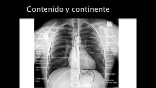 evaluacion de radiografia de torax [upl. by Krein605]