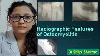 Radiographic Features of Osteomyelitis [upl. by Salzhauer]