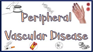 Peripheral Vascular DiseasePVD Causes Signs amp Symptoms Diagnosis ampTreatment [upl. by Eiryt]