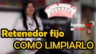 RETENEDOR FIJO  Como limpiarlo  Odontología Láser [upl. by Yaniv511]