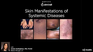 Skin Manifestations of Systemic Disease  November 5 2020 [upl. by Yesrod]