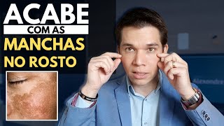 Acabe com as MANCHAS NA PELE inclusive MELASMA  Receita Caseira [upl. by Ahsienel]