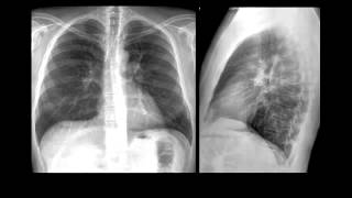 Radiografía de Tórax Evaluación Básica Inicial [upl. by Rebhun]