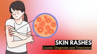 Skin Rash Causes Signs and Symptoms Diagnosis and Treatment [upl. by Fredrick]