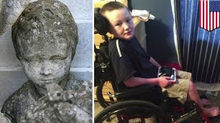 Stiff skin syndrome Rare condition is turning boy to stone  TomoNews [upl. by Lune]