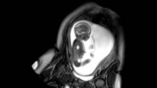 Foetal Development Unborn Baby Movement at 24 Weeks  WIRED [upl. by Meggie]