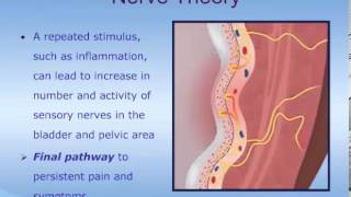 Understanding Interstitial Cystitis ICPainful Bladder Syndrome PBS [upl. by Anitap]