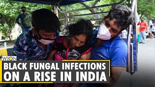 COVID19 Black fungal infections on a rise in India [upl. by Yelah295]