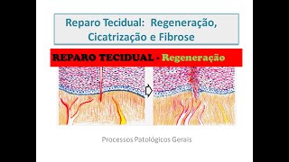 Reparo Tecidual Regeneração [upl. by Pesvoh204]