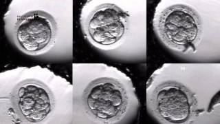 IVF PROCESS STEP BY STEP In Vitro Fertilisation Embryo cultivation [upl. by Mcgean]