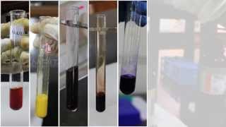 Qualitative Analysis of Amino Acids  Amrita University [upl. by Nolita]