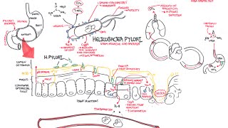 Helicobacter pylori Diagnosis [upl. by Soisanahta325]