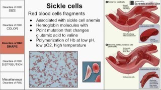 Red Blood Cell Morphological Abnormalities [upl. by Nydia]