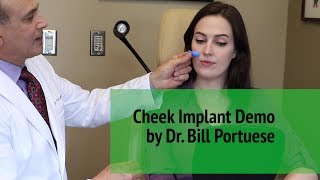 How Do Cheek Implants Work With Facial Plastic Surgeon  Dr William Portuese  Seattle Washington [upl. by Prudi]